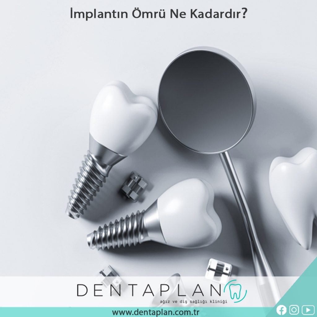 Diş İmplantının Ömrü Ne Kadardır?